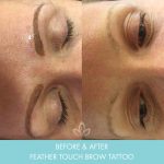 feather touch brows before and after 001 - eyebrow tattoo - Academy Face & Body