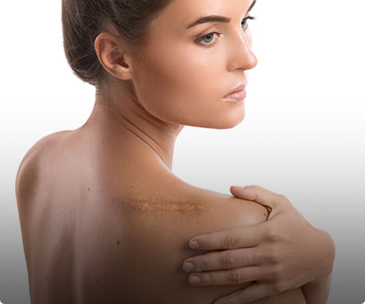 Venus VIVA treatment - Academy Face & Body Perth